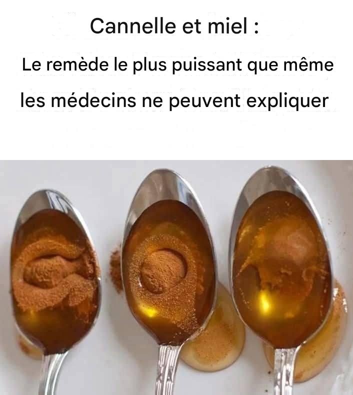 Cannelle et miel un remède puissant que même les médecins ne peuvent expliquer pleinement.